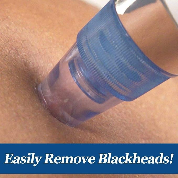 4-in-1 Electric Blackhead Remover Vacuum | Derma Suction Pore Cleaner Tool for Men & Women | Acne, Pimple & Whitehead Extractor | Facial Skin Care Device
